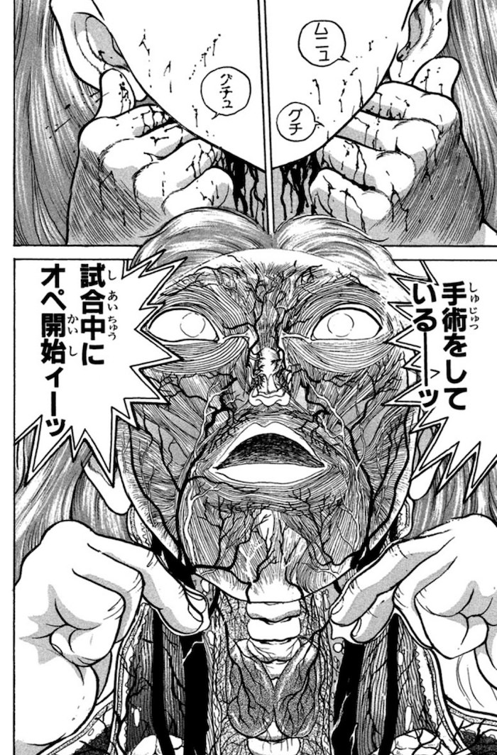 試合中にオペ（手術）する鎬紅葉（弟・昴昇に紐切りされた）